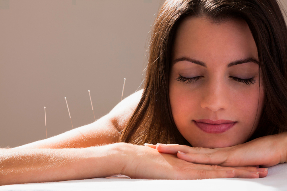 Acuflex Holistics - Acupuncture Acuflex Holistics - Acupuncture